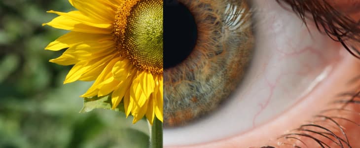 3 Treatment Options For Nearsightedness Myopia